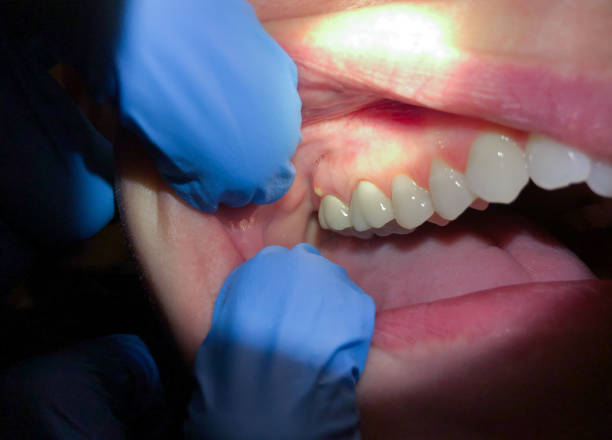 Best Walk-In Emergency Dentist in Hayfork, CA